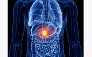 Five Early Warning Signs of Cancerous Growth in the Body