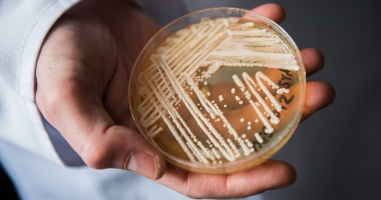 7,700 reported cases of deadly fungus across 30 states